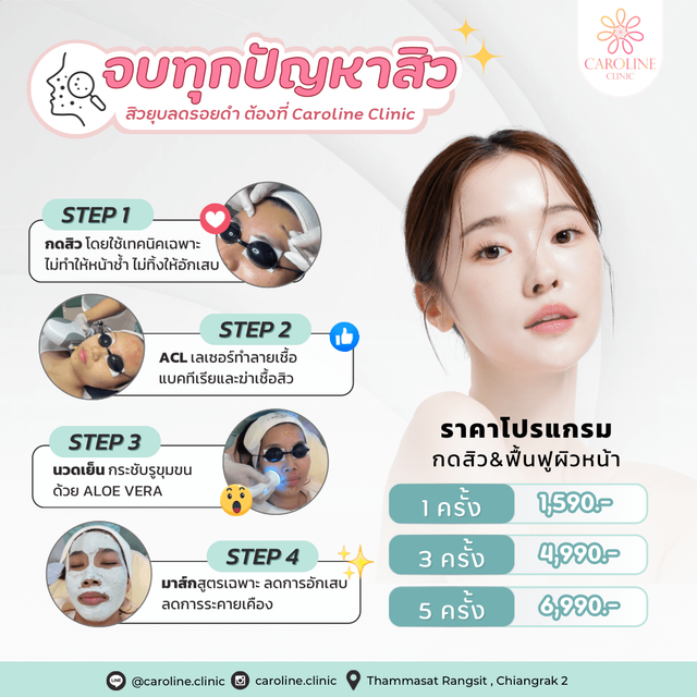 ชื่อโปรโมชันที่ 22