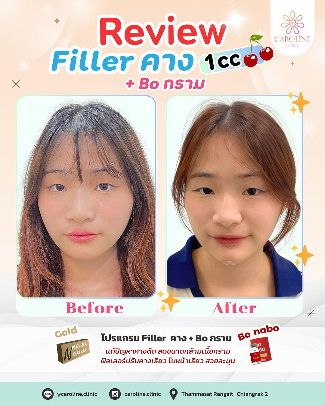 รีวิว 1
