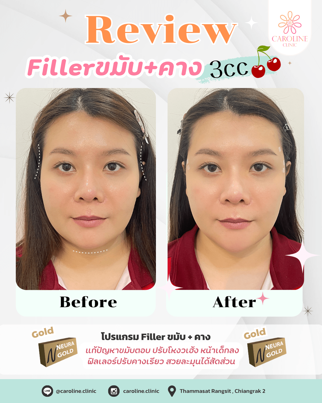 รีวิว 11