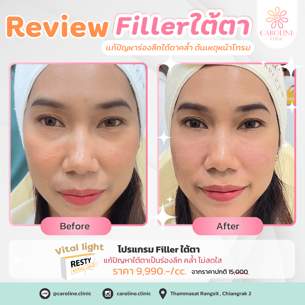 รีวิว 14