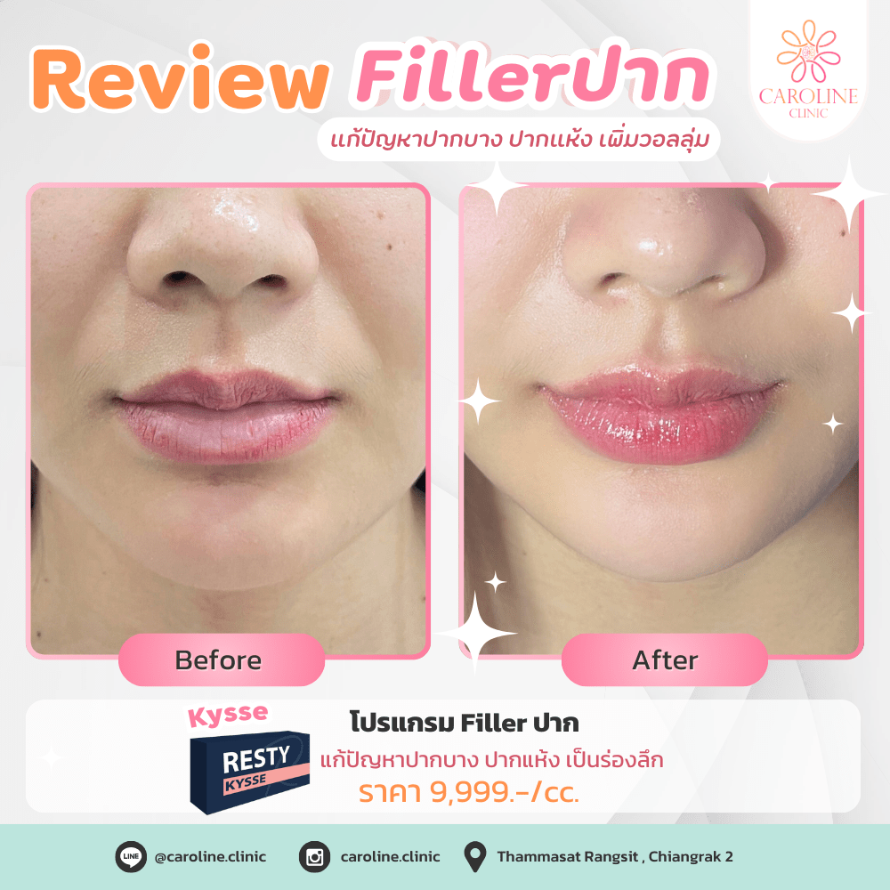 รีวิว 15