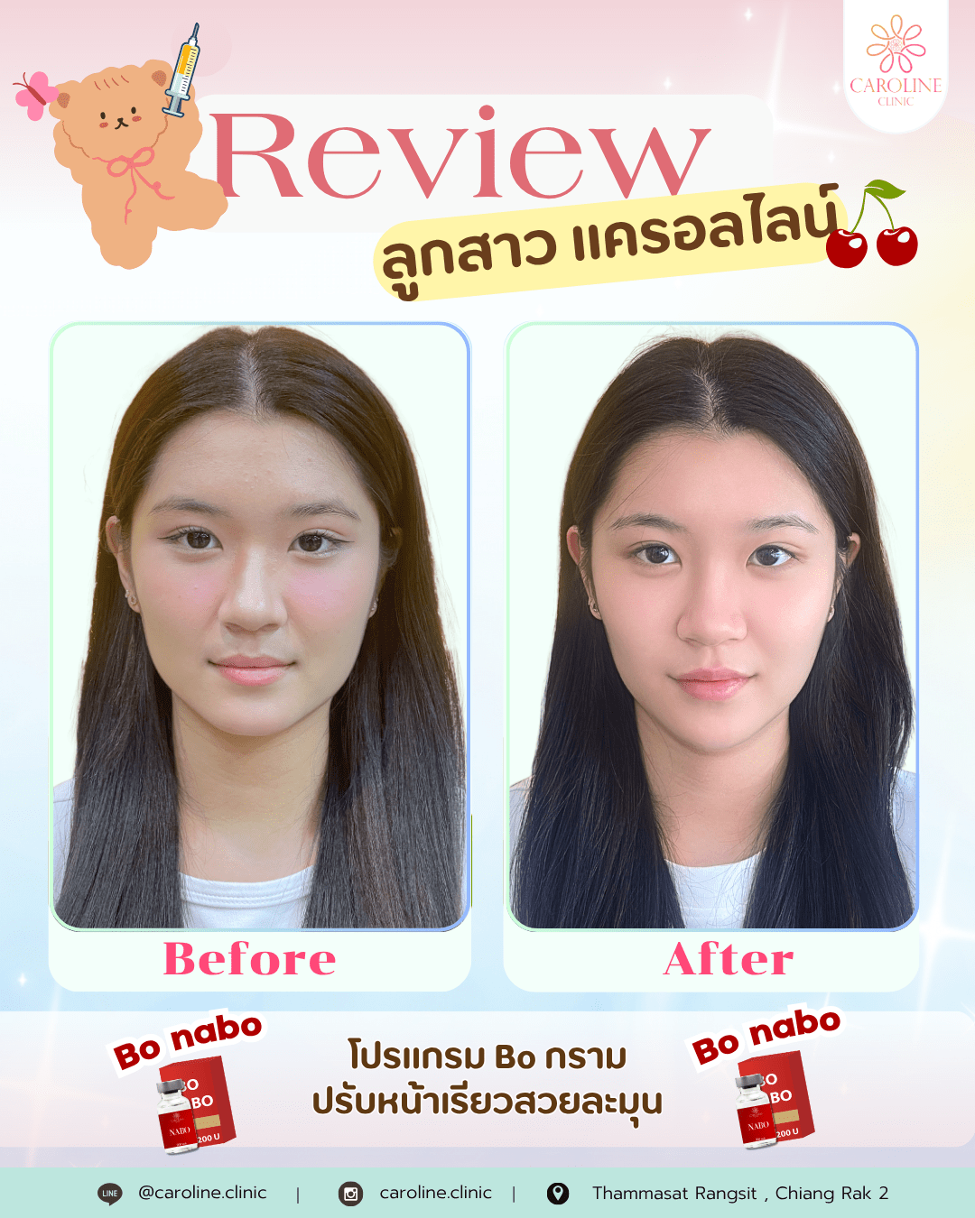 รีวิว 2