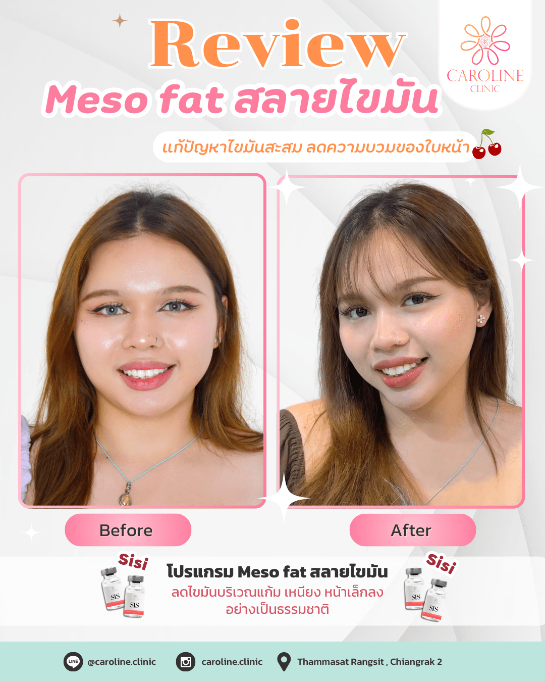 รีวิว 3