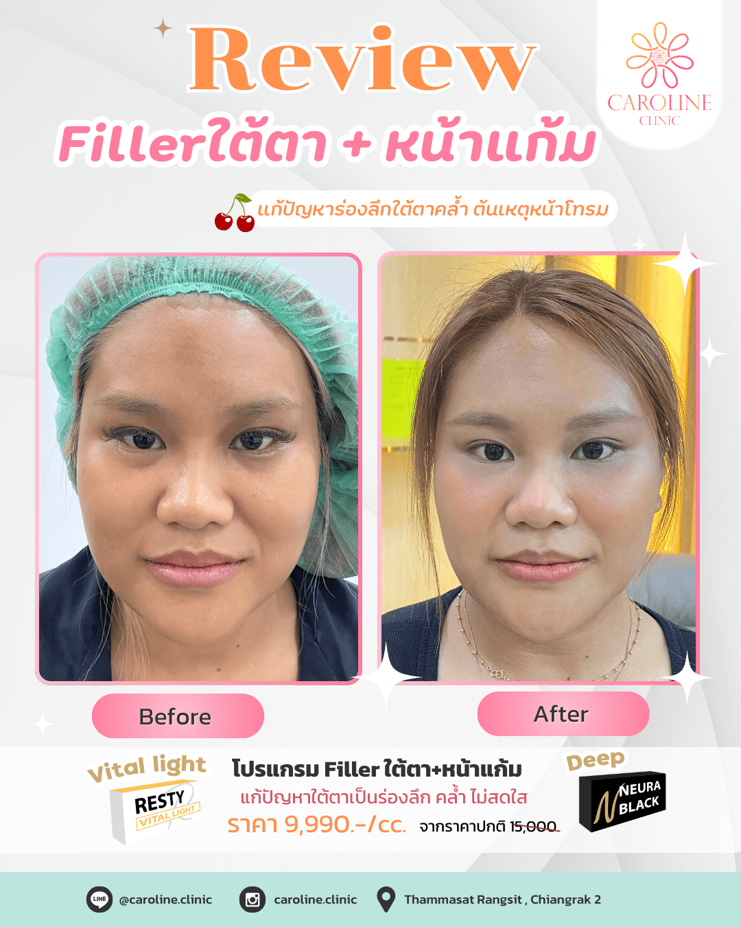 รีวิว 5