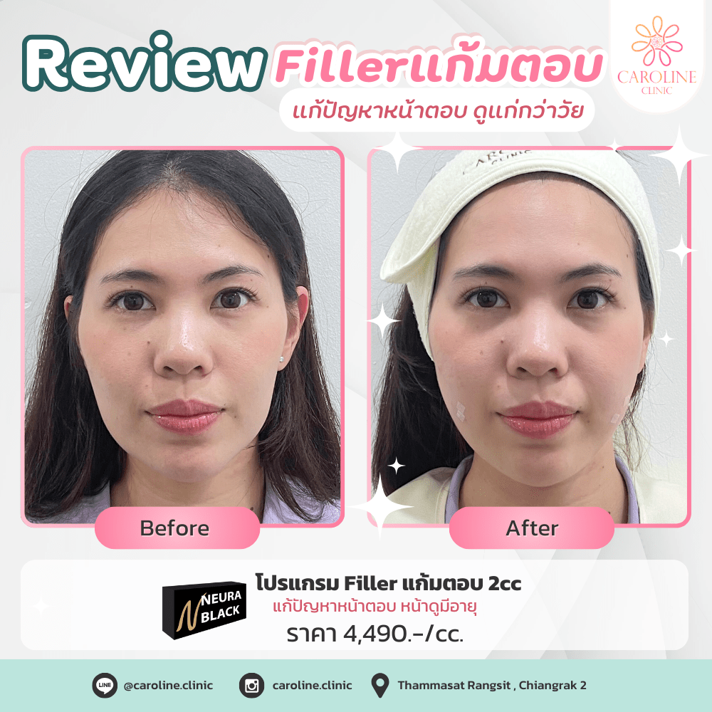 รีวิว 7