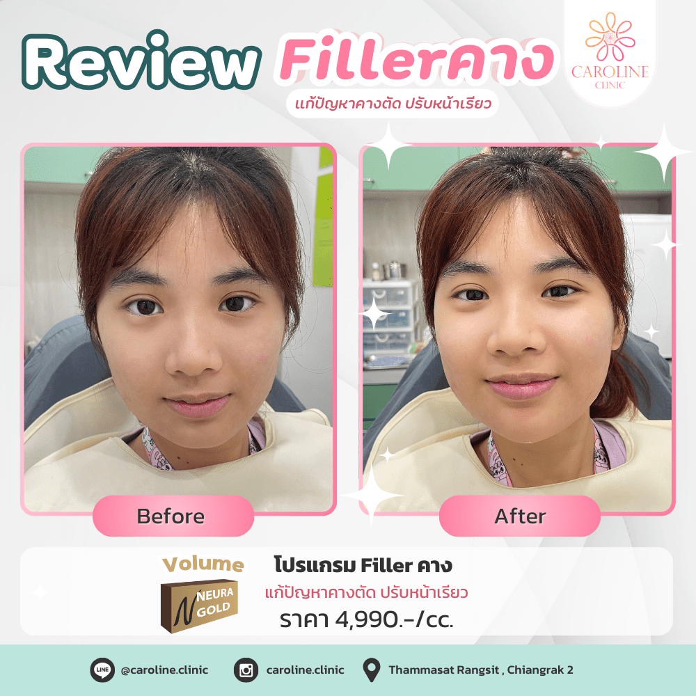 รีวิว 9